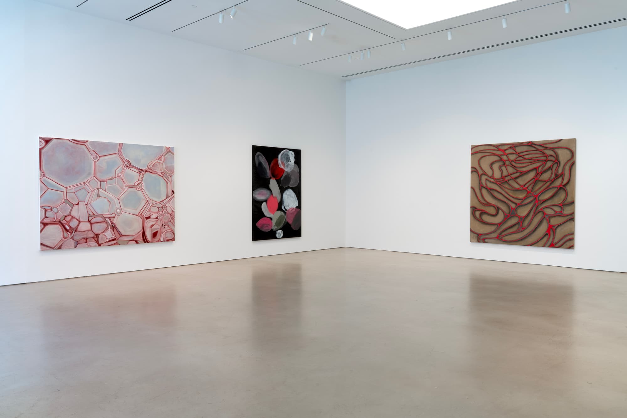 Installation view 1 of 7