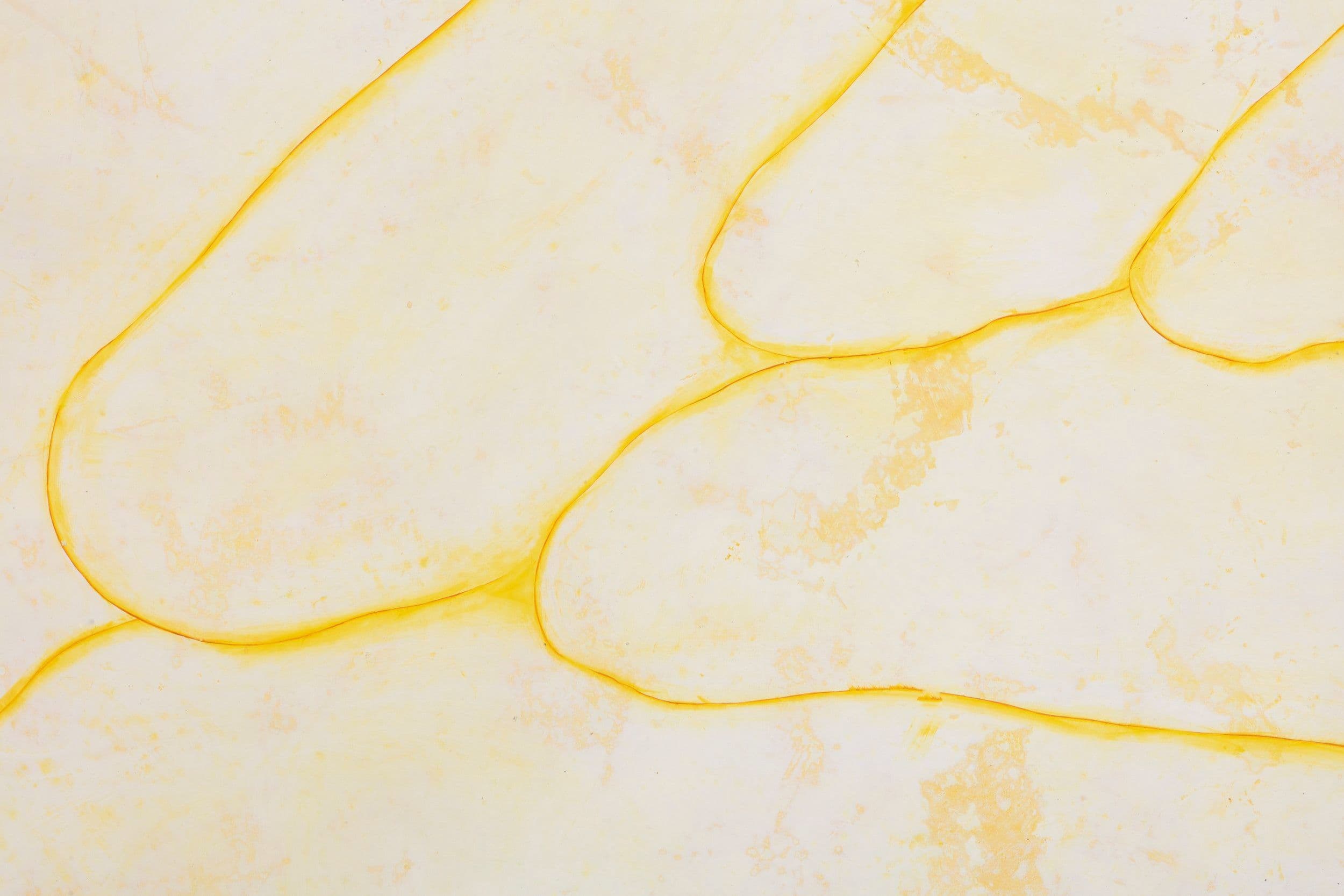 Obsessed with forgetting what it is