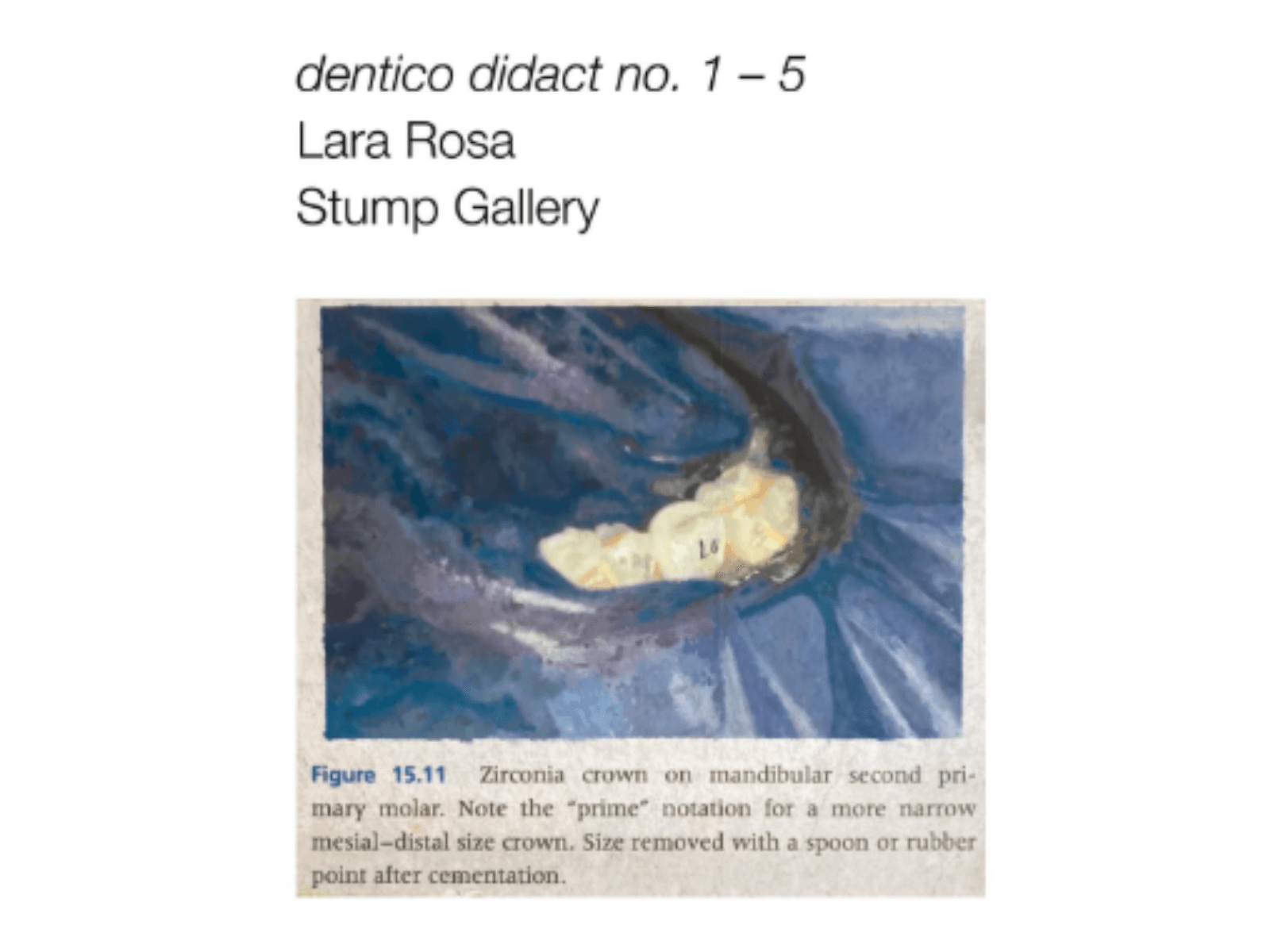 Lara Rosa: dentico didact no. 1 – 5