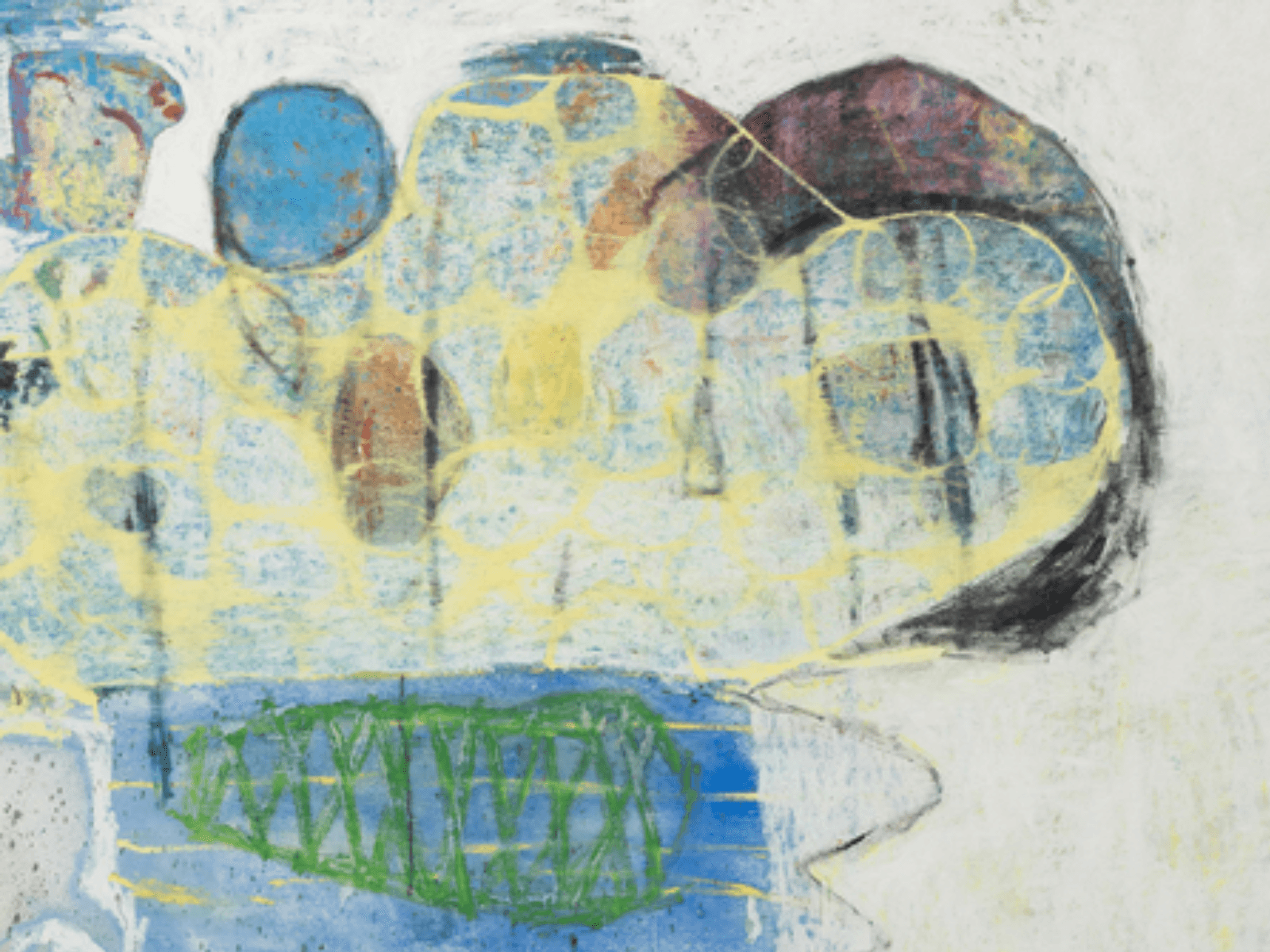 June Canedo de Souza: All top teeth knocked out at once