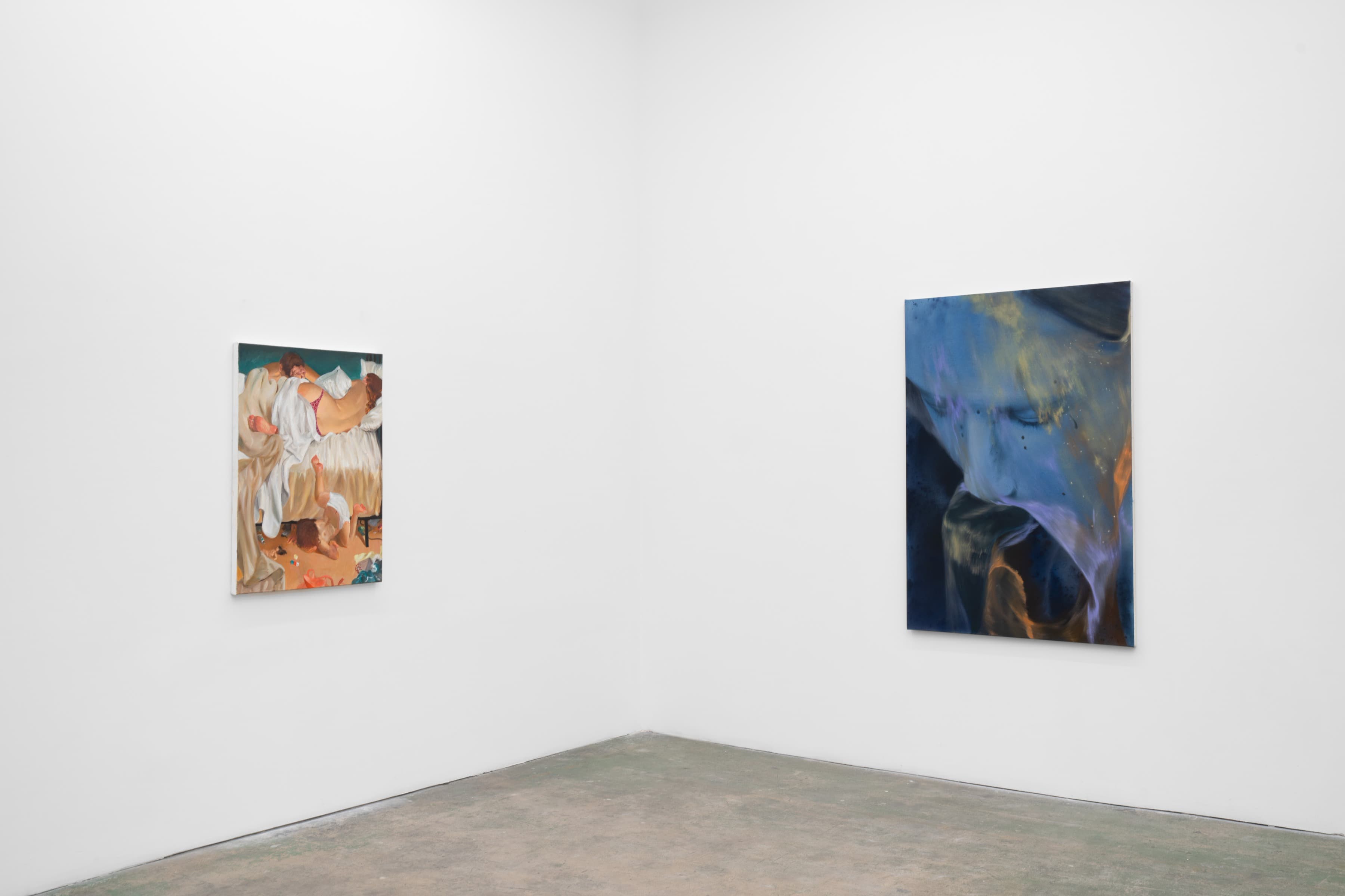 Installation view